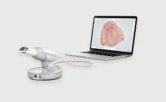 口内スキャナーを使用使用した苦痛のない治療